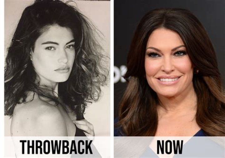 Kimberly Guilfoyle Transformation: Before And After Surgery