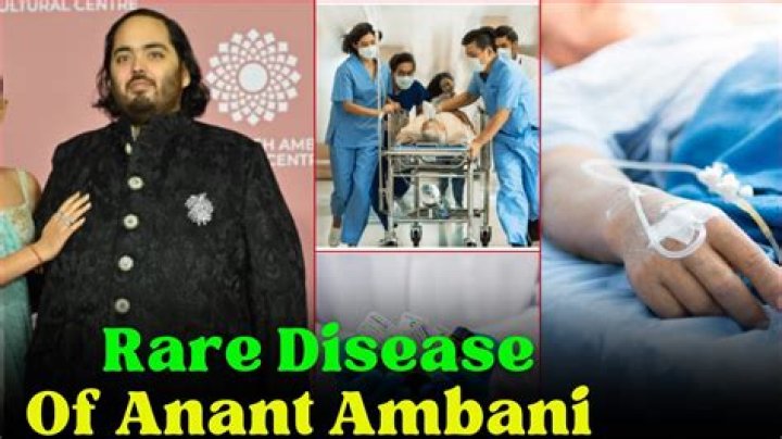 Revealed: Anant Ambani's Rare Disease | Understanding His Health Condition